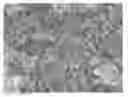 Fig. 01 - COATED BALLOON CATHETER AND COMPOSITION FOR COATING SAID BALLOON CATHETER