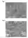 Fig. 02 - COATED BALLOON CATHETER AND COMPOSITION FOR COATING SAID BALLOON CATHETER