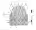 Fig. 01 - Sealing structure for heart valve implants