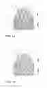 Fig. 02 - Sealing structure for heart valve implants