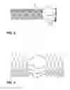 Fig. 03 - Sealing structure for heart valve implants