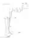 Fig. 02 - Limited-access, reduced-pressure systems and methods