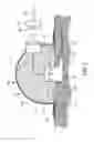 Fig. 03 - Detachable percutaneous connector