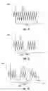Fig. 07 - Systems and methods for correcting and preventing occlusion in a catheter