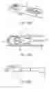 Fig. 44 - Spacer assembly for drug delivery system