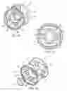 Fig. 06 - Tamper evident syringe tip cap