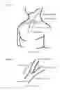 Fig. 02 - Drainage devices and methods for use