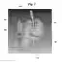 Fig. 09 - Trajectory optimization in radiotherapy using sectioning