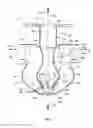 Fig. 06 - Diffusion horn