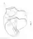 Fig. 06 - Frontal airbag assemblies for reducing rotational velocity of a head of an occupant