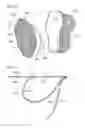 Fig. 10 - Airbag device