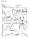 Fig. 11 - Brake device