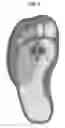 Fig. 05 - Pedal