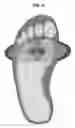 Fig. 06 - Pedal