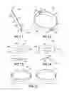 Fig. 04 - Bistable pull-snap hold open mechanism and method