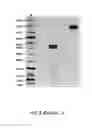 Fig. 04 - METHODS OF USING BISPECIFIC ANTIGEN-BINDING CONSTRUCTS TARGETING HER2