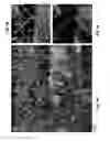 Fig. 07 - METHOD FOR VASCULARIZING IN-VITRO GENERATED OR EX-VIVO TISSUE FRAGMENTS IN A MICROFLUIDIC DEVICE