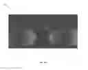 Fig. 02 - Microfluidic device for three dimensional and compartmentalized coculture of neuronal and muscle cells, with functional force readout