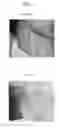 Fig. 04 - Immortalized stem cell, compositions, preparations and uses thereof