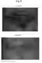 Fig. 07 - Immortalized stem cell, compositions, preparations and uses thereof