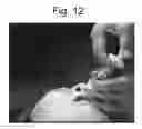 Fig. 12 - Immortalized stem cell, compositions, preparations and uses thereof
