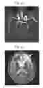 Fig. 13 - Immortalized stem cell, compositions, preparations and uses thereof