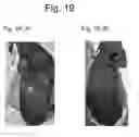 Fig. 18 - Immortalized stem cell, compositions, preparations and uses thereof
