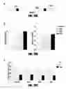 Fig. 13 - Modulation of alternative MDM2 splicing