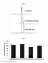 Fig. 07 - Multi-enzyme conjugate, method for preparing the same and method for preparing organic compound using the same