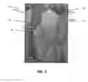 Fig. 04 - Multilayer structured coatings for cutting tools