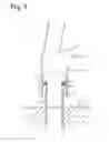 Fig. 05 - Temporarily coupling between jacket and pile and method of coupling