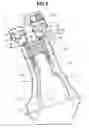 Fig. 06 - GAS-LIQUID SEPARATION DEVICE FOR BLOW-BY GAS IN ENGINE