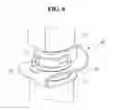 Fig. 07 - Injector clip