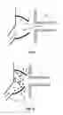 Fig. 06 - Suction acoustic filter and suction line including suction acoustic filter