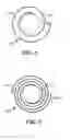 Fig. 03 - Anchor