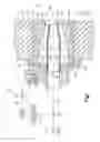 Fig. 02 - Low NOx combustion