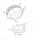 Fig. 06 - Water meter with magnetically driven flow restriction valve
