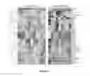 Fig. 03 - Blood biomarkers for appendicitis and diagnostics methods using biomarkers