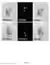 Fig. 19 - Rationale, methods, and assays for identifying human and non-human primate taste specific genes and use thereof in taste modulator and therapeutic screening assays