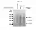 Fig. 09 - Compositions and methods for treating multiple myeloma