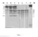 Fig. 02 - Method for visualizing biomolecules, such as proteins or nucleic acids, with the unaided eye, without needing to use potentially toxic compounds, exposure to ultraviolet (UV) light or fluorescence