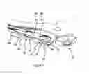 Fig. 07 - Shape memory alloy wire attachment structures with adhesive for a suspension assembly