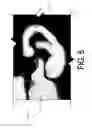 Fig. 06 - Microphone control via contact patch
