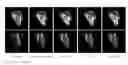 Fig. 01 - Sequential learning technique for medical image segmentation