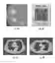 Fig. 07 - Systems, methods and devices for analyzing quantitative information obtained from radiological images