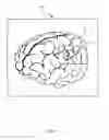 Fig. 07 - Method, system and apparatus for automatically evaluating resection accuracy