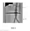 Fig. 04 - Apparatus for determining positions of an interventional instrument in a projection image