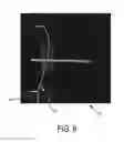 Fig. 09 - Apparatus for determining positions of an interventional instrument in a projection image