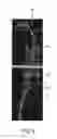 Fig. 10 - Apparatus for determining positions of an interventional instrument in a projection image