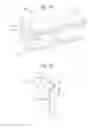 Fig. 02 - Stator assembly